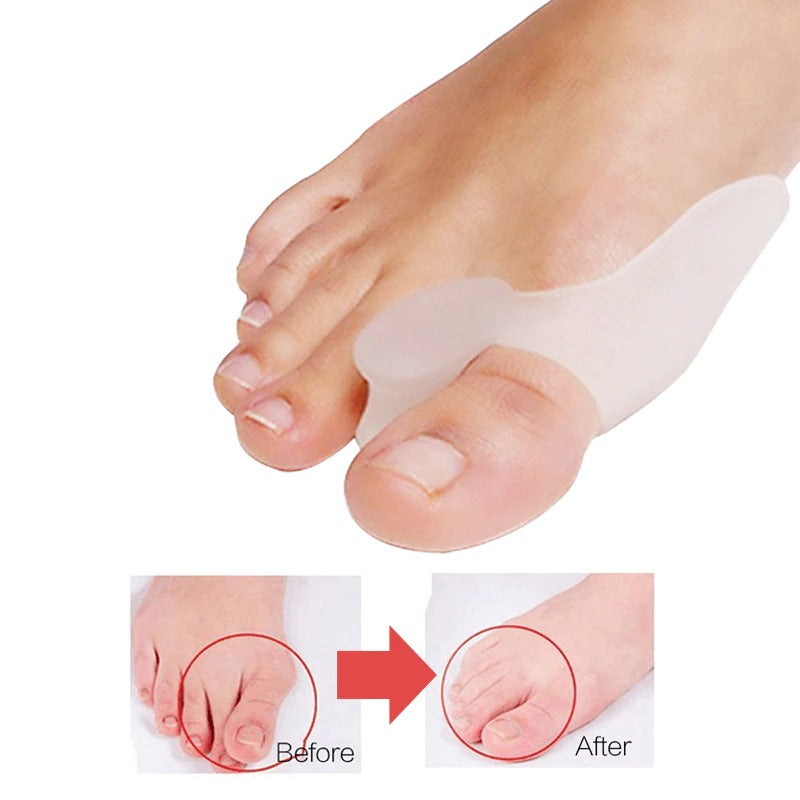 Foot Posture Corrector (Pack of 2)