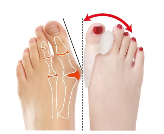 Foot Posture Corrector (Pack of 2)