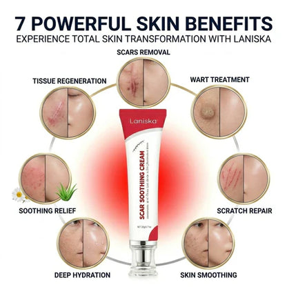 Laniska Scar Soothing Cream