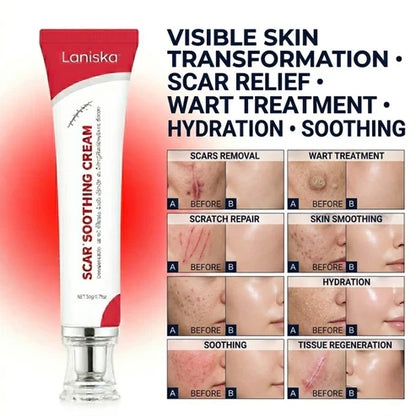 Laniska Scar Soothing Cream