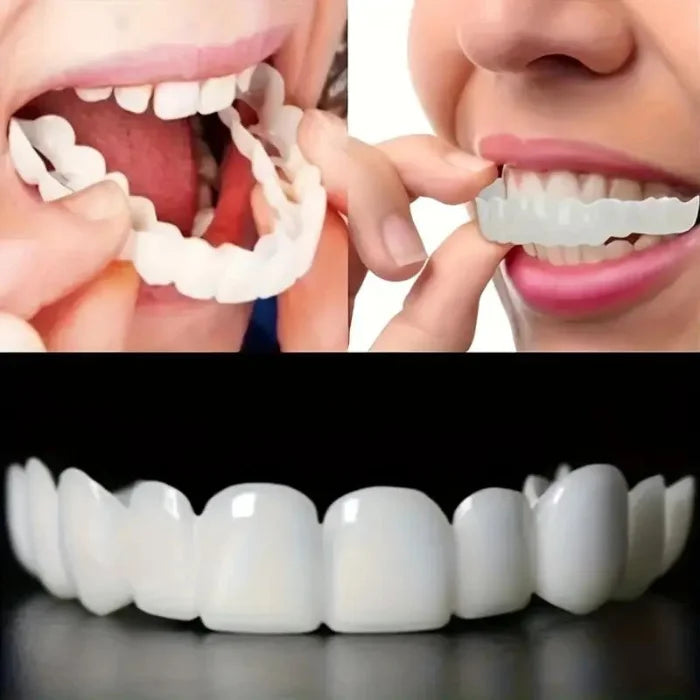 Snap On Smile