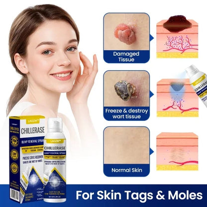 LAOZIKÂ® ChillErase Bump Remover (Massay & Mouke Remover)