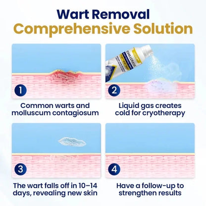 LAOZIKÂ® ChillErase Bump Remover (Massay & Mouke Remover)